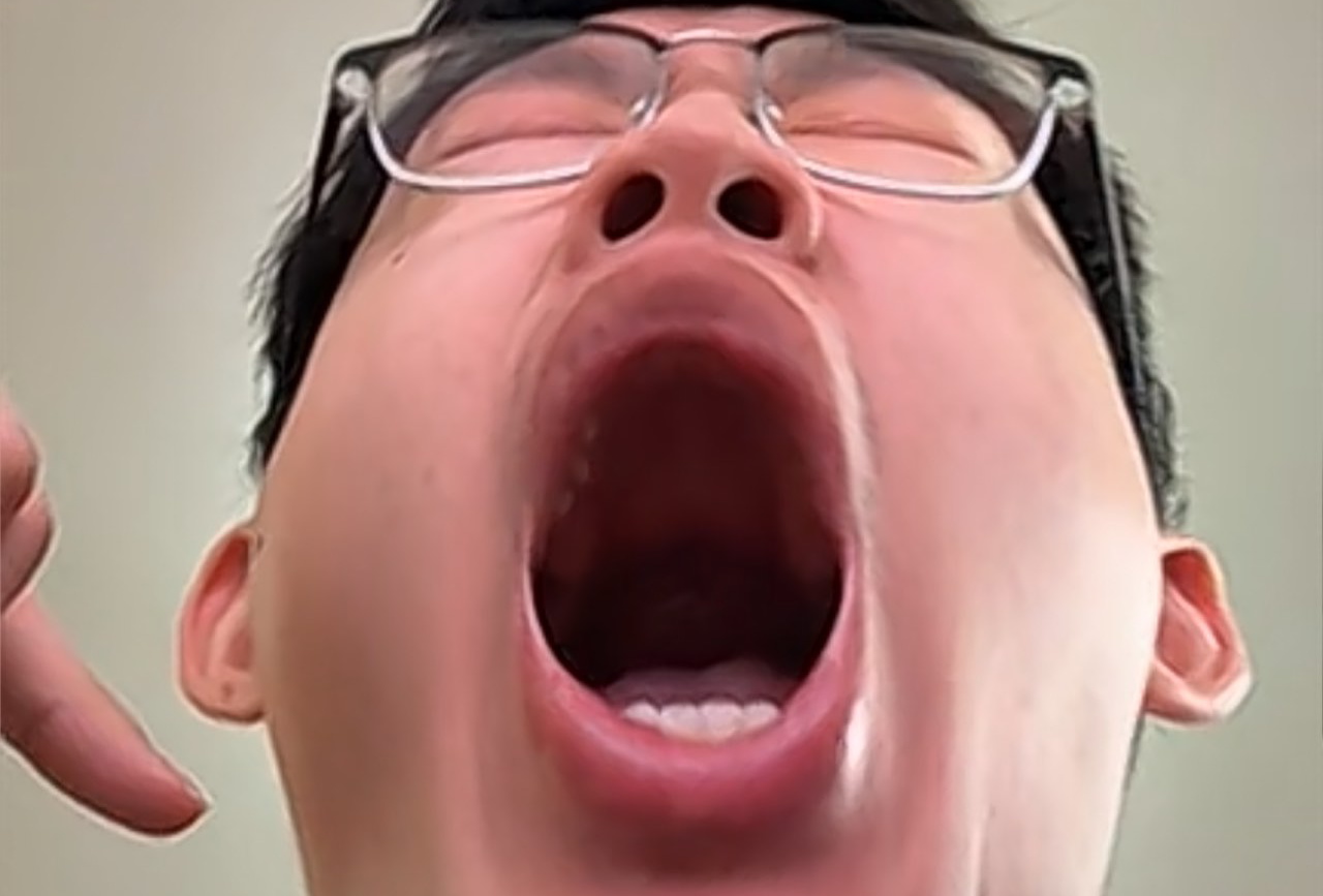 咪能吃点啥呢？